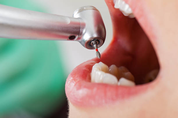 Best Emergency Root Canal Treatment in Mcgaheysville, VA